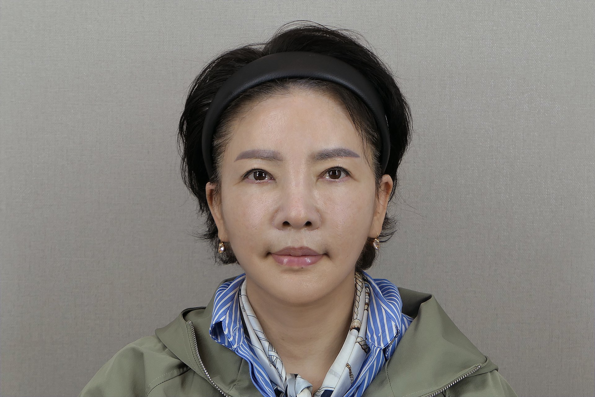수술 후