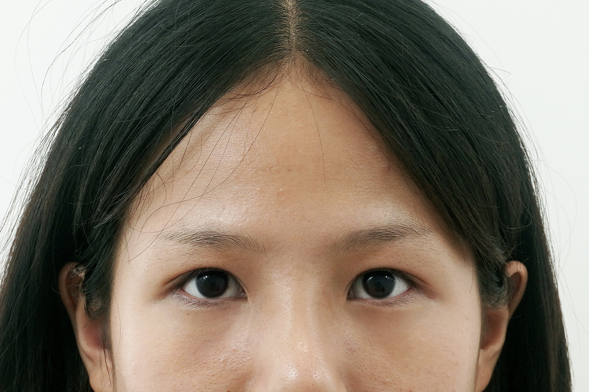 수술 후
